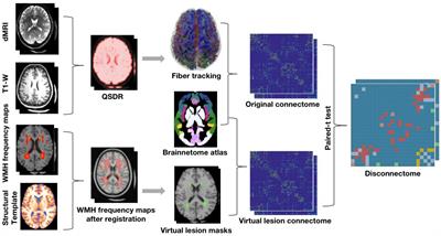 Disconnectome associated with progressive white matter hyperintensities in aging: a virtual lesion study